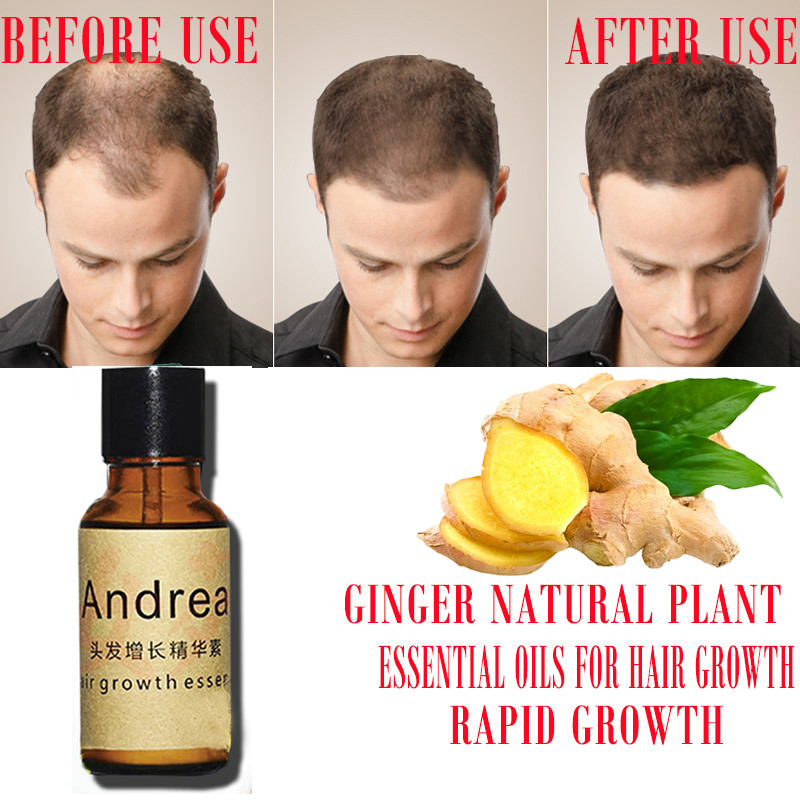 2/5/10Pcs Andrea Hair Growth S - đánh giá và giá Biotin Hair Growth