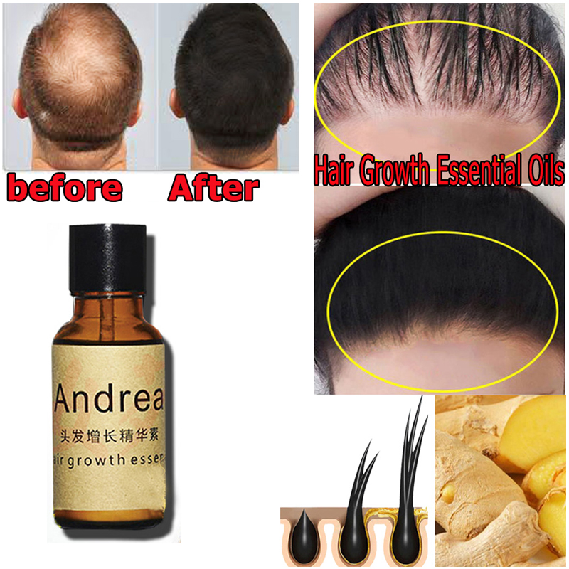 2/5/10Pcs Andrea Hair Growth S - đánh giá và giá Biotin Hair Growth